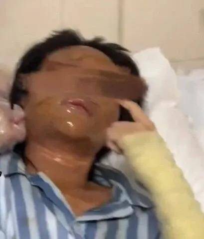 皇冠信用網网址
_女主播称遭伪装快递包裹炸伤皇冠信用網网址
,湖南警方通报