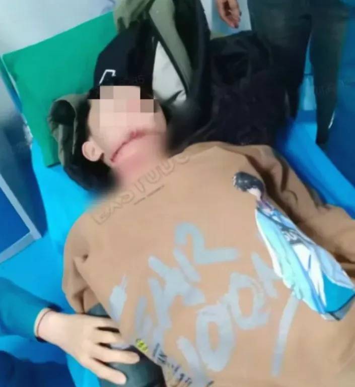 皇冠代理登录地址_河南13岁被锁喉男孩赴京治疗后已脱离生命危险皇冠代理登录地址,拉绳老人已被采取刑事强制措施